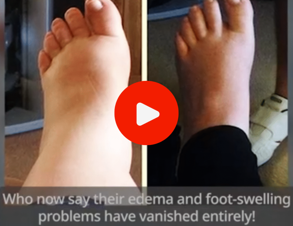 swollen feet and ankles